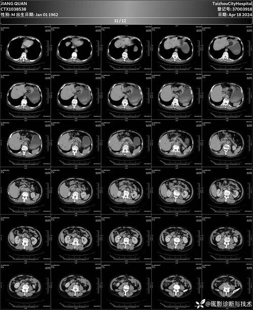 CTimg什么意思,mg什么意思单�? style=