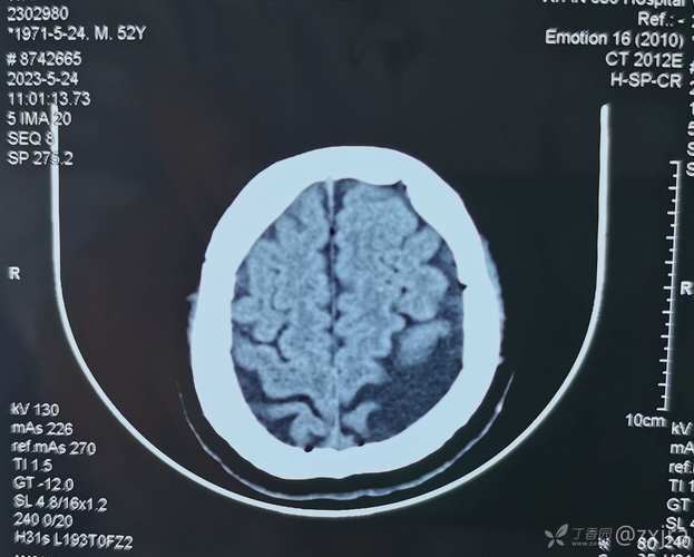 CTimg什么意思,mg什么意思单�? style=