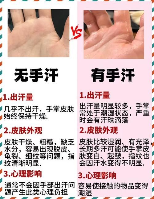 玩游戏手心出汗是病吗？如何缓解手汗困扰！