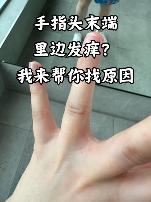 玩游戏手指出汗怎么办？这几个小妙招帮你解决！