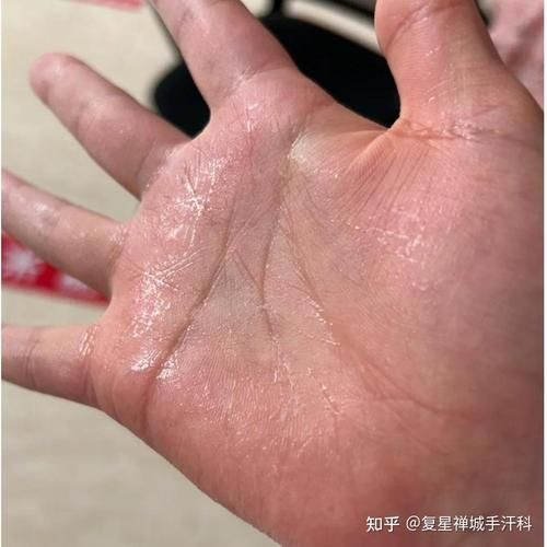 玩游戏手指出汗怎么办？这几个小妙招帮你解决！
