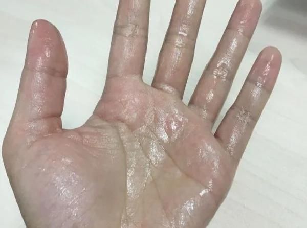 玩游戏手汗多影响操作？简单方法让你告别烦恼！