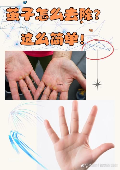 玩游戏手滑怎么办？这几个小技巧让你告别失误！