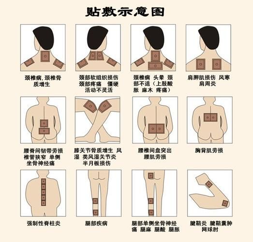 贴膏药游戏教案哪里找？这几个方法简单又实用！