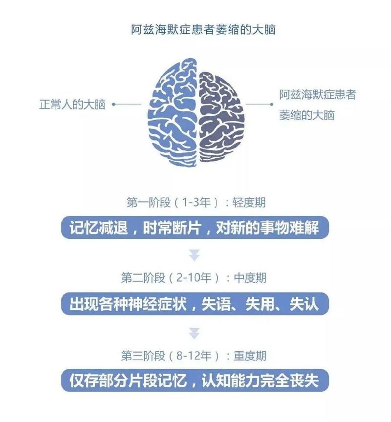 适合老年人防痴呆的游戏，帮你远离阿尔茨海默！
