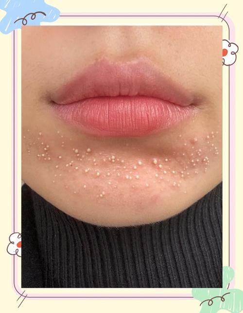 curegirl是什么揭秘这款神奇产品的真实效果