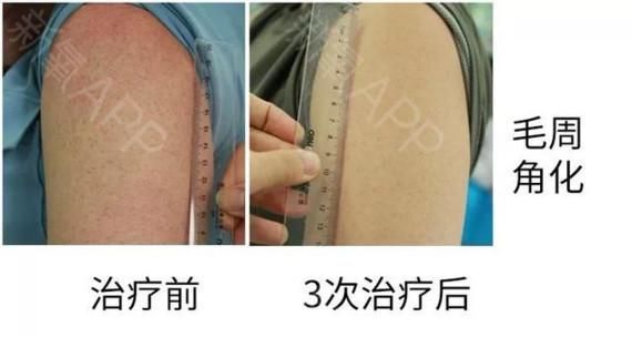 dsx换肤小助手怎么用 手把手教你轻松换肤