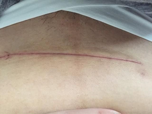 wow刀疤怎么抓 详细攻略带你快速入手刀疤