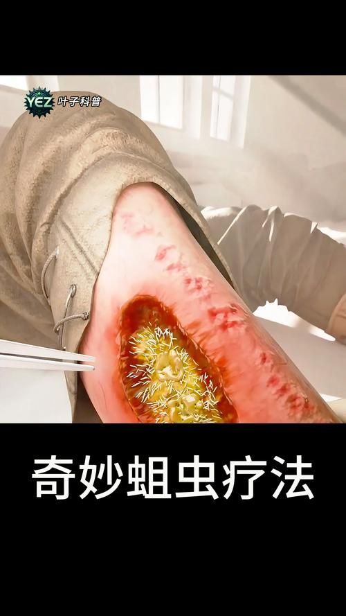 wow贪吃的蛆虫有什么用 详细作用解析