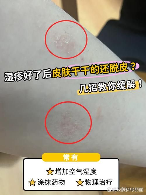 为什么有时候皮肤干燥脱皮还容易过敏