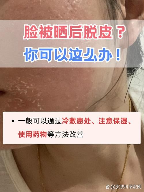 为什么有时候皮肤干燥脱皮还容易过敏