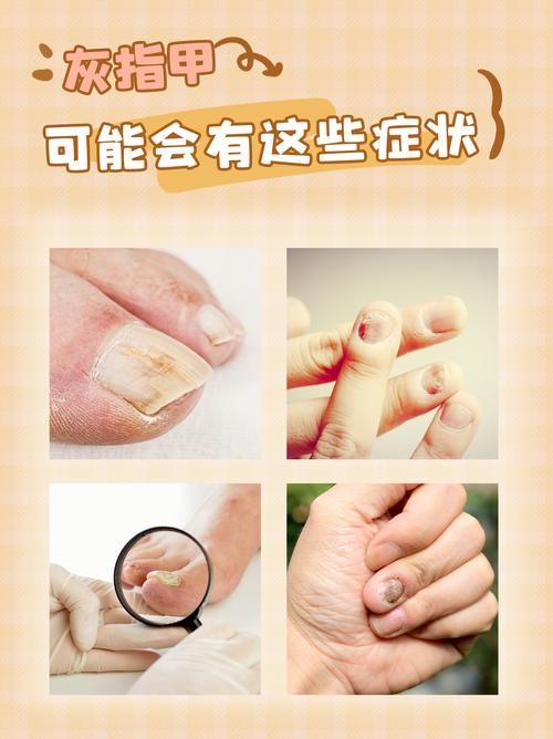 人指甲可以入药吗 这些传统用法你知道吗