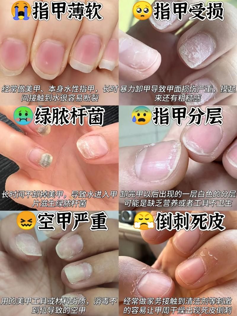 人指甲可以入药吗 这些传统用法你知道吗