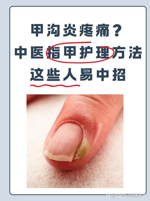 人指甲可以入药吗 这些传统用法你知道吗