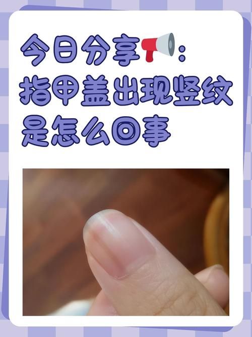 人指甲可以入药吗 这些传统用法你知道吗