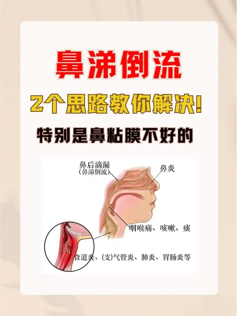 哭泣时也会流鼻涕 教你快速止住的小妙招