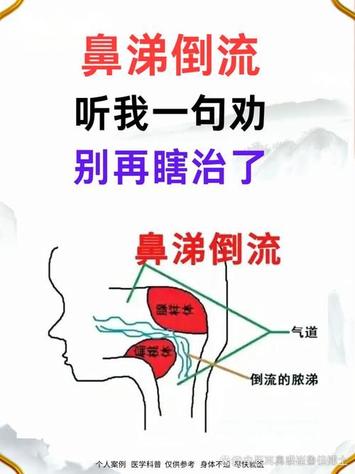 哭泣时也会流鼻涕 教你快速止住的小妙招
