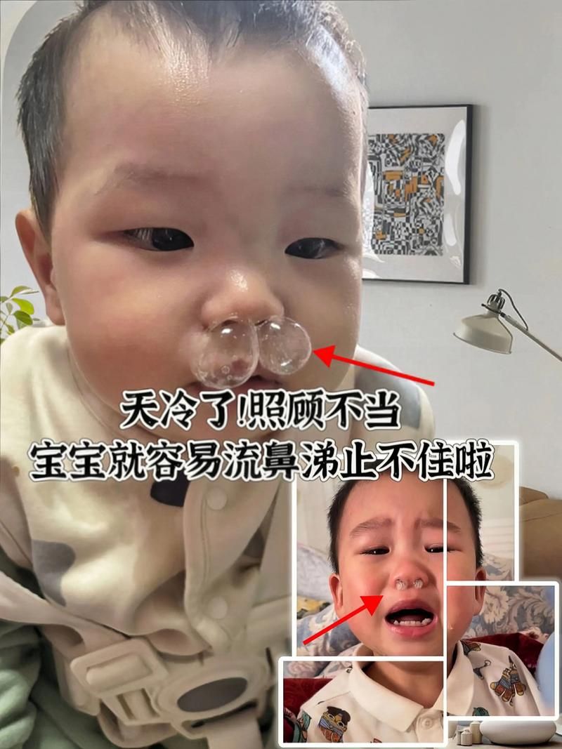 哭泣时也会流鼻涕 教你快速止住的小妙招