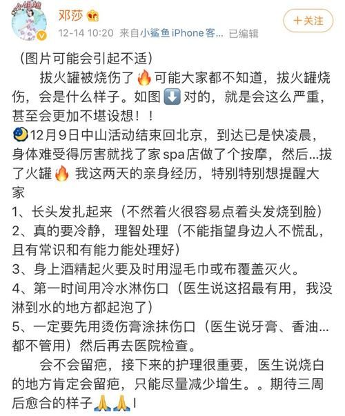 如何在微博发文章 这些注意事项你一定要知道