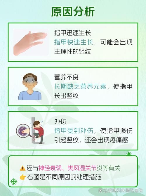 指甲竖纹蚂蚁庄园解析指甲竖纹的原因
