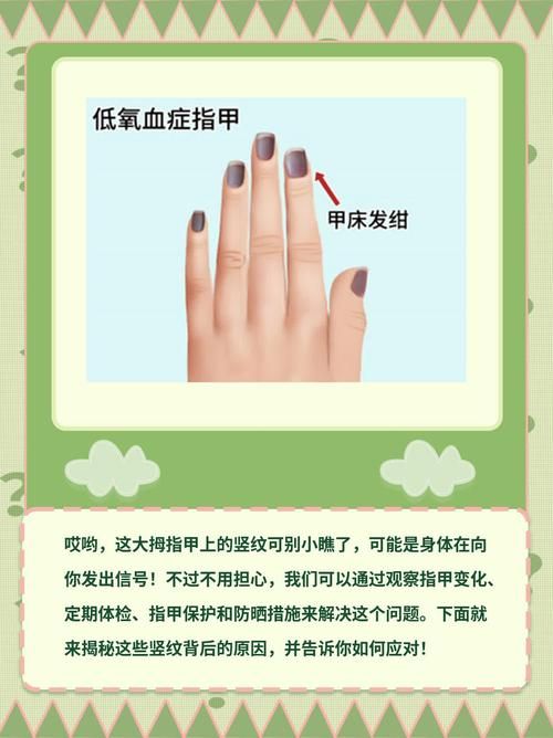 指甲竖纹蚂蚁庄园解析指甲竖纹的原因