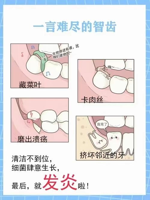 智齿人人都会长吗 不长智齿正常吗