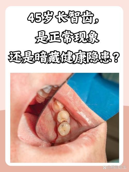 智齿人人都会长吗 不长智齿正常吗