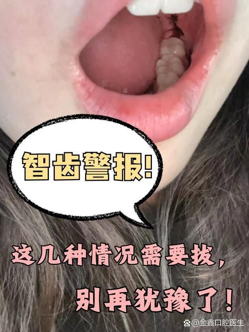 智齿人人都会长吗 不长智齿正常吗