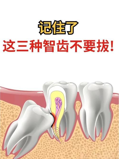 智齿人人都会长吗 不长智齿正常吗