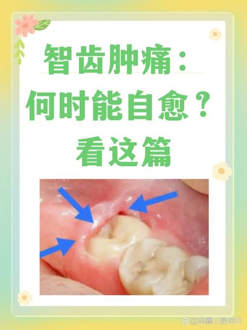 智齿人人都会长吗 不长智齿正常吗