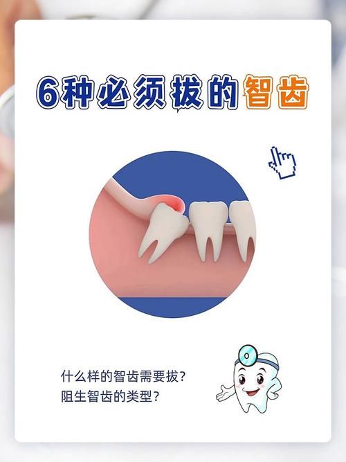 智齿人人都会长吗 不长智齿正常吗