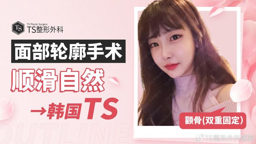 ts女陪是什么意思 年轻人都在讨论的新兴社交现象