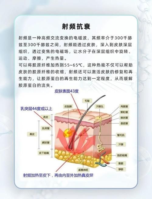射频的作用和功效大揭秘 射频美容的优缺点分析