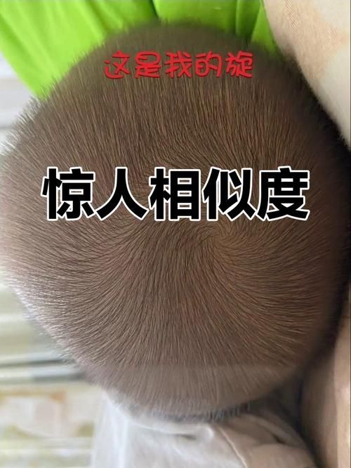 小白长得很像他哥哥妈妈都认错了