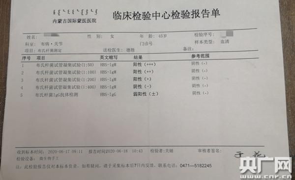 广电网络宽带怎么样适合打游戏吗延迟测试报告